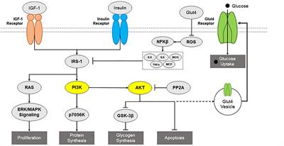 Role of Insulin in Neurotrauma and Neurodegeneration: A Review
